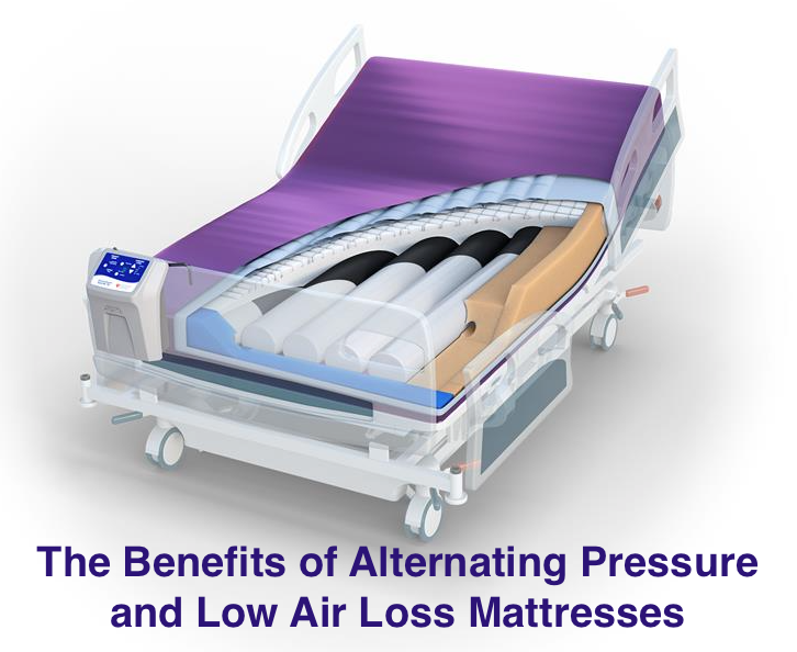 The Benefits of Alternating Pressure and Low Air Loss Mattresses